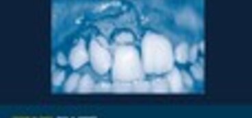Dental Traumatology - January 2022 issue now available